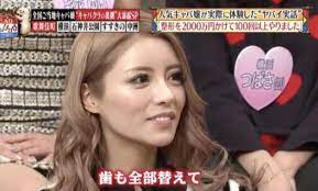 一条響の整形前後の顔の変化がヤバい!豊胸や整形外科クリニックについてもまとめてみた ダウンロード 7 1 - 一条響の整形前後の顔の変化がヤバい!豊胸や整形外科クリニックについてもまとめてみた