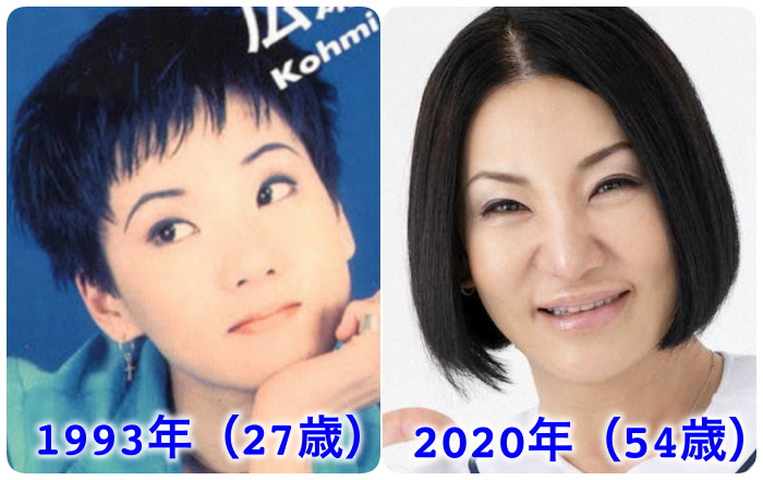 広瀬香美は整形しすぎ?整形前の顔(昔)と現在を比較してみた! 比較画像 - 広瀬香美は整形しすぎ?整形前の顔(昔)と現在を比較してみた!